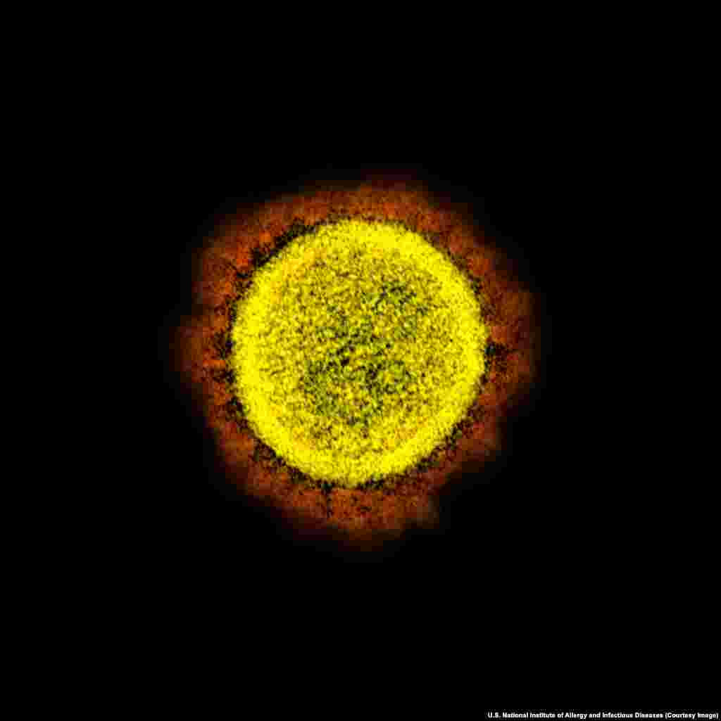 Вирион SARS-CoV-2. Под микроскопом вокруг вируса видны отростки, напоминающие солнечную корону, поэтому в его названии присутствует слово &laquo;корона&raquo;. В переводе с латинского &laquo;корона&raquo; означает ореол или венец.